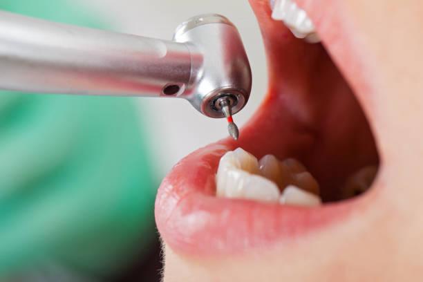 Best Knocked-Out Tooth Emergency  in Norwood, OH